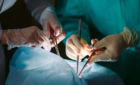 В Бишкеке российские врачи провели операцию 14 детям с нарушениями челюстно-лицевой области