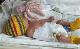 В Жалал-Абадской области растет количество младенцев, рожденных недоношенными