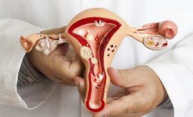 Более 50% женщин с раком шейки матки умирают в первые полгода после постановки диагноза, – онколог
