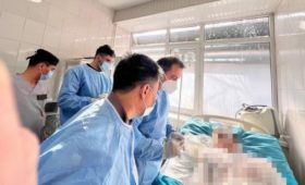 Двух пострадавших на ТЭЦ переведут в клинику Турции