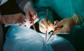 Кыргызские хирурги готовы проводить операцию по трансплантации печени, – врач