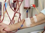В Кыргызстане ежегодно количество нуждающихся в услугах гемодиализа увеличивается на 300 пациентов