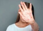 Как отличить корь от других заболеваний? Симптомы