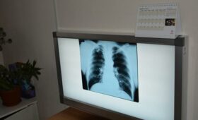 Случай туберкулеза в школе №41: Все сотрудники школы проходят обследование