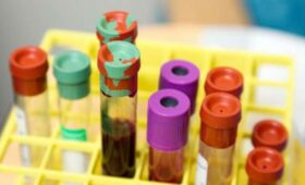 Ученые обнаружили белки крови, которые могут предупредить рак за 7 лет до постановки диагноза