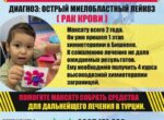Срочная помощь нужна двухлетнему Максату