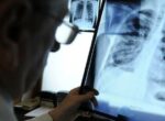 В Кыргызстане идет стабильное снижение заболеваемости и смертности от туберкулеза, — НЦФ