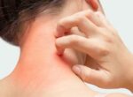 Кыргызстанцы могут бесплатно получить консультацию, диагностику и лечения аллергии