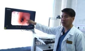 В Бишкеке врачи без операции извлекли монету из желудка ребенка