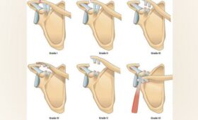 Врачи из Узбекистана представили алгоритм выбора тактики лечения переломов ключицы на конференции в КГМА