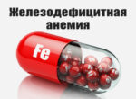 Признаки дефицита железа в крови: советы медиков