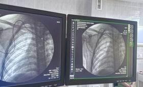 Растет количество обращений от семей с детьми с онкологией, — директор общественного фонда «Верю в чудо»