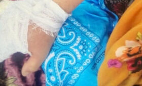 В Аксы выявлена сибирская язва, госпитализирован 20-летний парень