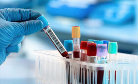 Ученые создали анализ крови, выявляющий более 50 видов рака за 3 года до появления симптомов