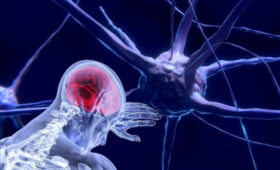 Инсульт легче предупредить, чем лечить, — врачи