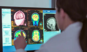 Юность длится до 30 лет: новое исследование определило пять этапов возраста человеческого мозга