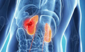 Сменный график работы повышает риск мочекаменной болезни, — исследование