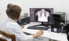 ФОМС разъясняет порядок оплаты рентгенографии