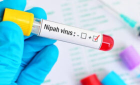Минздрав: Вирус Нипах не угрожает Кыргызстану, но контроль на границе усилен