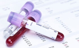 В Кыргызстане начнут скрининговые обследования детей по уровню свинца