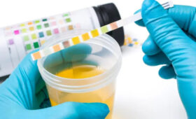 Все врачи Кыргызстана должны пройти сертификацию по алкотестам, — МВД