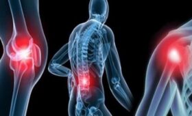 Ревматоидный артрит: симптомы, лечение и профилактика