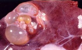 Инфекционист рассказала об особенностях эхинококкоза и как им можно заразиться