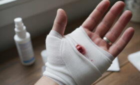 Почему некоторые раны долго заживают? Ученые назвали причину