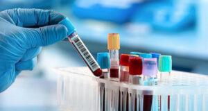 «Теряется драгоценное время»: Депутат предлагает проводить тест на совместимость крови прямо в госбольницах