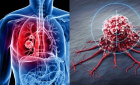 Онкологи назвали основные причины развития рака в Кыргызстане