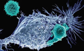 337 новых случаев — онкология становится угрозой для здоровья жителей Нарынской области» />