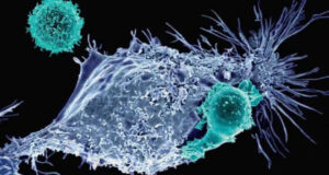 337 новых случаев — онкология становится угрозой для здоровья жителей Нарынской области» />