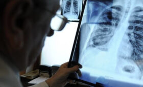 25 лет статистики: Где в Кыргызстане чаще болеют дети туберкулёзом» />