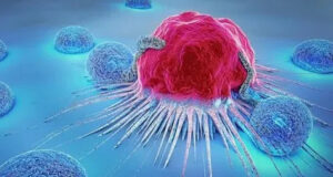 Профилактика онкологических заболеваний