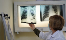 Минздрав: поставки бария для рентген-исследований скоро начнутся