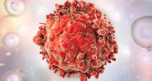 Ситуация с онкологической службой остается острой, — депутат