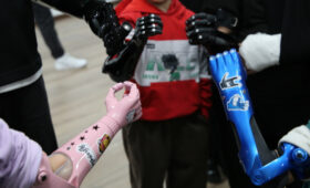 Более 11,5 тыс. человек получили протезно-ортопедические услуги в 2025 году, — Минтруда