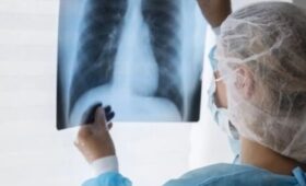 Военнослужащий ГСИН госпитализирован с туберкулёзом