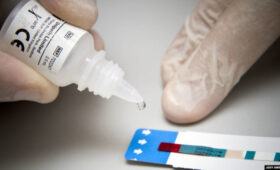 В Жалал-Абаде проводят экспресс-тестирование на ВИЧ: из 1481 обследованного инфекция выявлена у 7″ />