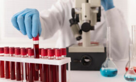 Кыргызстанцам напомнили о праве на бесплатные анализы